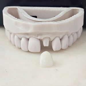 3D Printed Dental Teeth Mold With Crown
